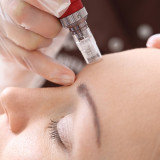 What is the Difference between Microneedling and Microdermabrasion?